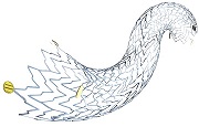 Peripheral stent